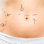 Modellare il proprio corpo con la liposuzione tumescente