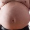 Sempre più uomini scelgono la chirurgia estetica